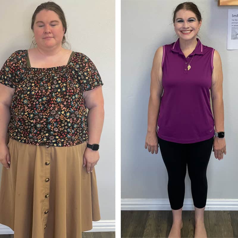Emily — Regal Weight Loss member who lost 141 pounds. Before and after photo.